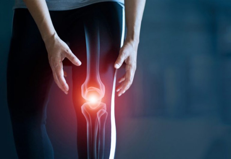 Osteoarthritis