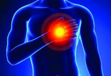 Heart attack (Myocardial Infarction)